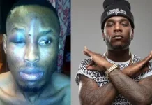 Record label took N8m out of N10m compensation I got after Burna Boy assaulted me – Mr 2Kay