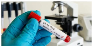 Ebola Outbreak: Africa CDC Reveals Why There Is No Approved Vaccine